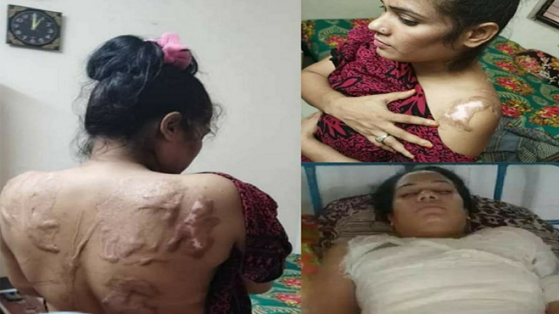 এসিড নিক্ষেপকারীর বিচার চাইলেন ঝলসে যাওয়া মুক্তিযোদ্ধার কন্যা
