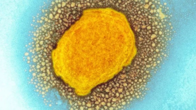 ১৫ দেশে ছড়াল মাঙ্কিপক্স