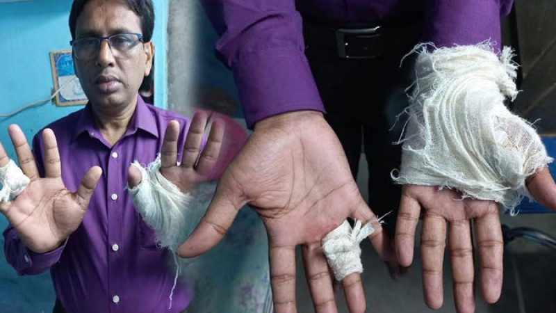 নোয়াখালীতে জামিনে বেরিয়ে শিক্ষা কর্মকর্তাকে প্রকাশ্যে হাতুড়িপেটা