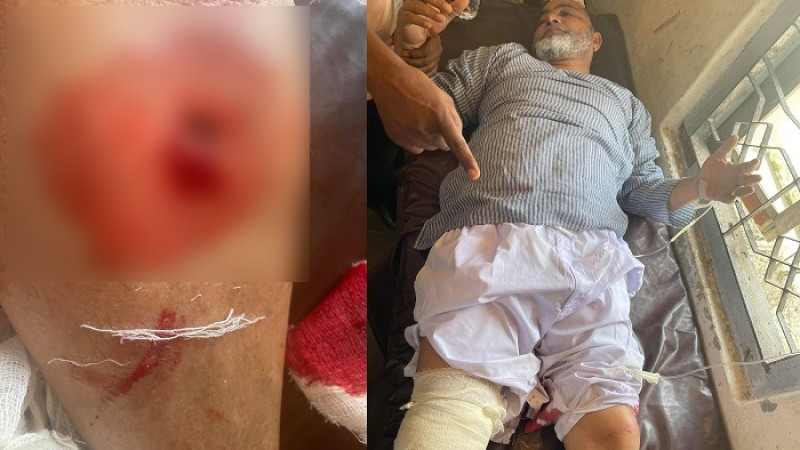 কাদের মির্জা অনুসারীদের গুলিতে উপজেলা আ.লীগের সাধারণ সম্পাদক গুলিবিদ্ধ