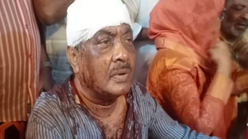 বিএনপির ভাইস চেয়ারম্যান বুলু ও তার স্ত্রীর ওপর হামলা