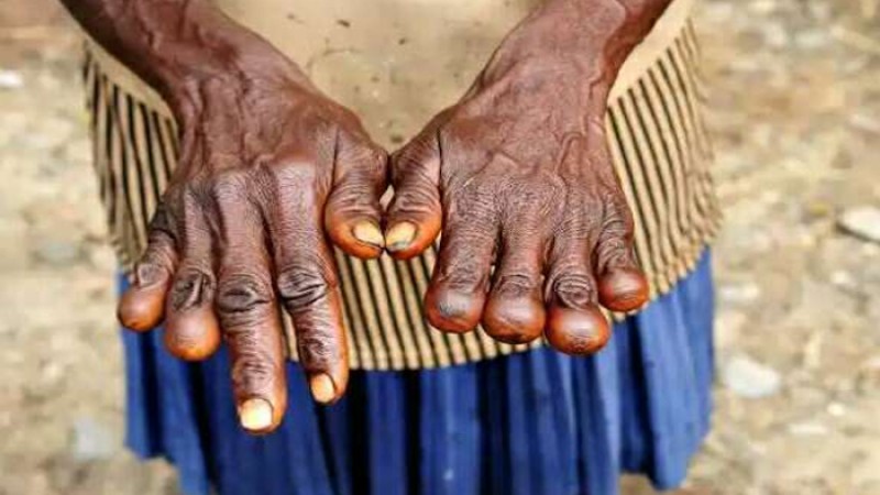 প্রিয়জনদের মৃত্যুতে নিজের আঙুল কেটে ফেলেন বাড়ির নারীরা