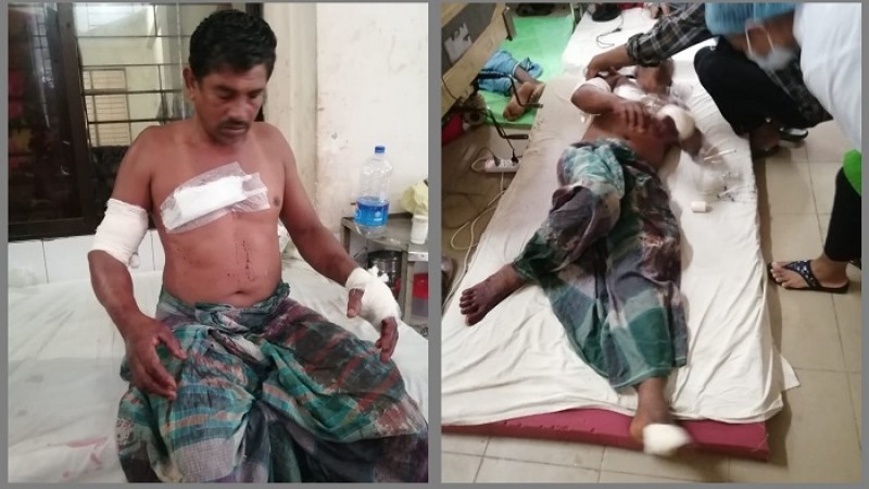 প্রশাসনের লোক পরিচয়ে ঘরে ঢুকে স্বামী-স্ত্রীকে কুপিয়েছে দুর্বৃত্তরা