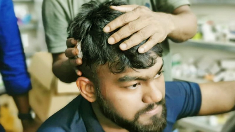 কোম্পানীগঞ্জে সংঘর্ষে কাদের মির্জার ছেলেসহ আহত ১০