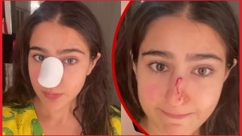 নাক কেটে ফেলেছেন সারা!