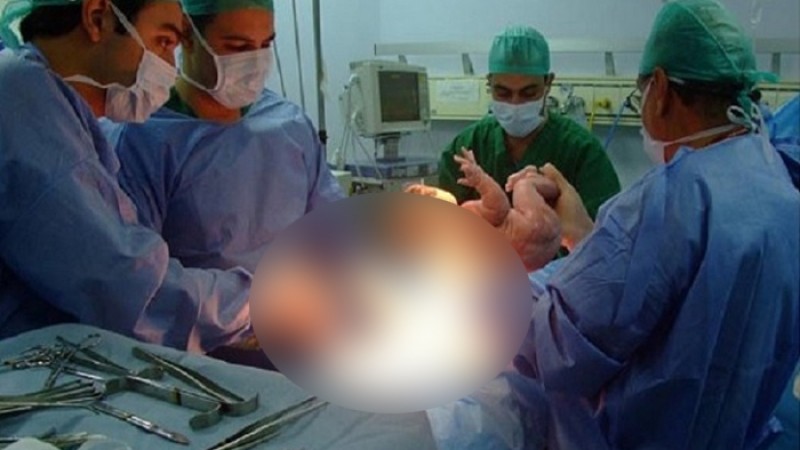 একবারের বেশি সিজার কতটা নিরাপদ?