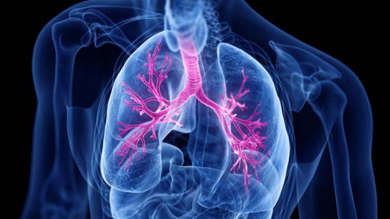 কাশির সঙ্গে কফ ওঠা সিওপিডির লক্ষণ নয় তো?