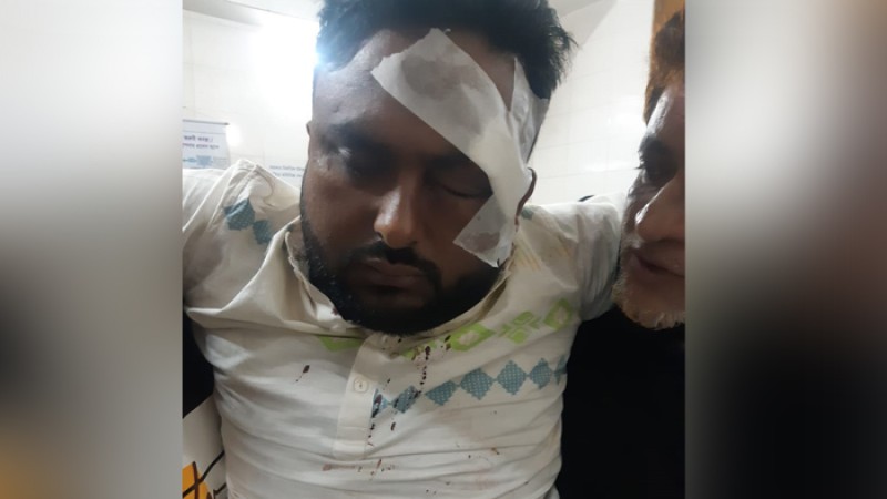 বেগমগঞ্জে চাঁদার দাবিতে কমিউনিটি সেন্টারে হামলা, আহত ৩