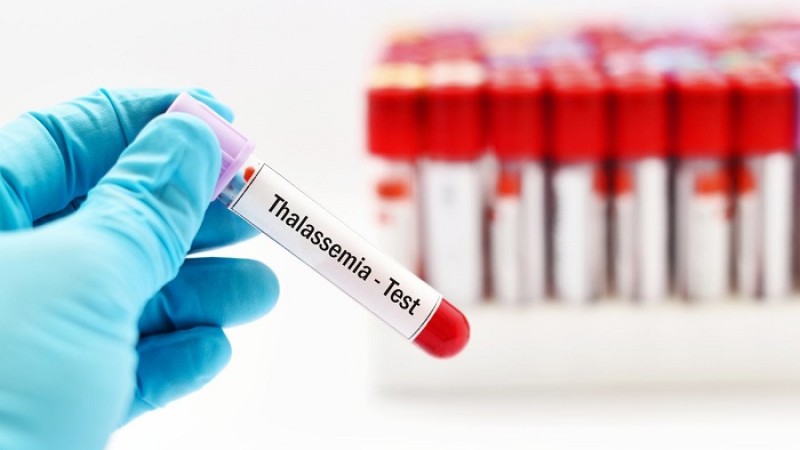 বিয়ের আগে যেসব মেডিকেল টেস্ট করা জরুরি