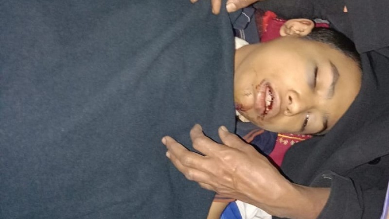 মাদ্রাসা ছাত্রকে ৪র্থ তলা থেকে ফেলে দেওয়ার অভিযোগ শিক্ষকের বিরুদ্ধে